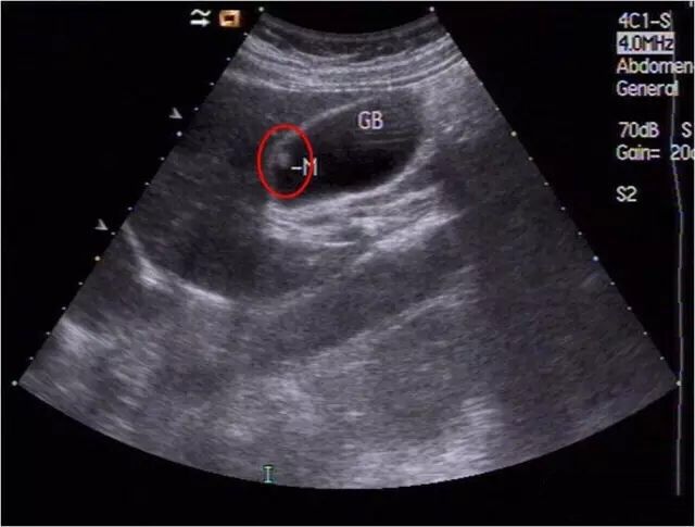 QQ图片20180813083252.jpg QQ图片20180813083252.jpg