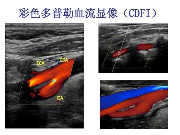 QQ图片20180813083252.jpg QQ图片20180813083252.jpg