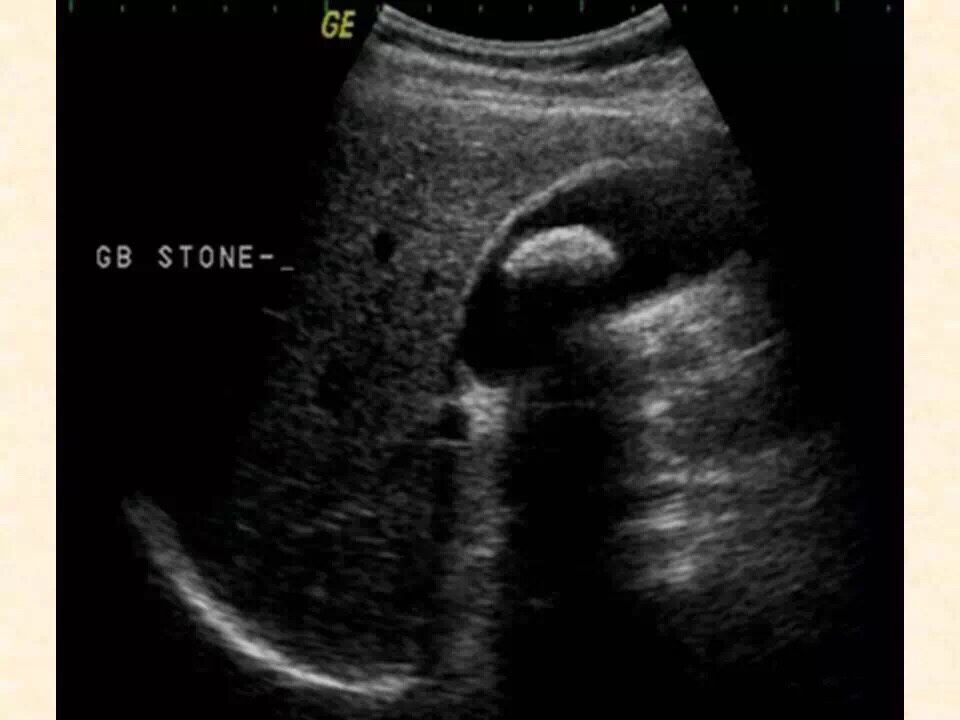 QQ图片20180813083252.jpg QQ图片20180813083252.jpg