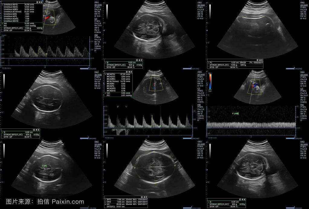 QQ图片20180813083252.jpg QQ图片20180813083252.jpg